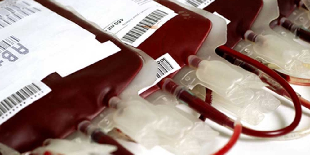 Umbilical Cord Blood Banking